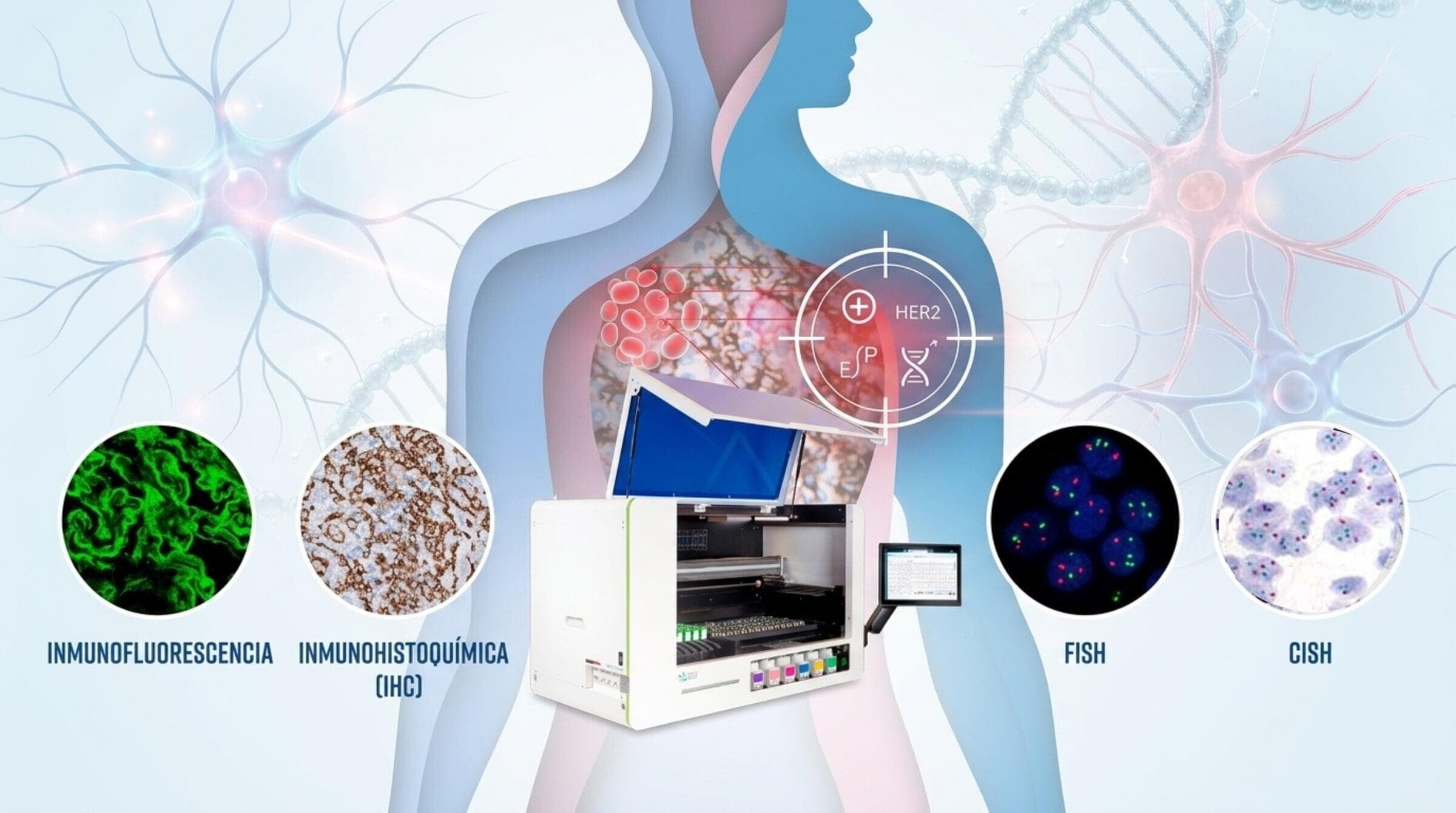 Inmunohistoquímica (IHC) / FISH / IF / CISH: las técnicas esenciales para el diagnóstico oncológico en el laboratorio de rutina